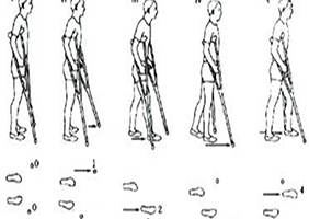 无锡国济护理院医师教您脊髓损伤步态训练